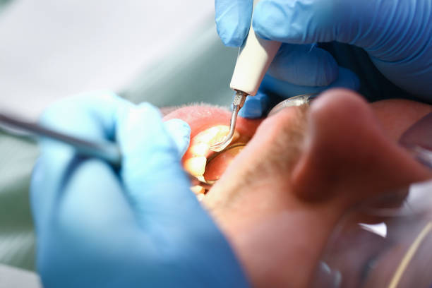 Best Emergency Treatment for Dental Infections or Abscesses in Imperial, CA