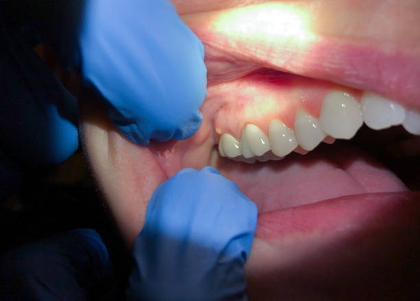 Best Urgent Care for Lost Fillings or Crowns in Imperial, CA